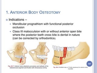1. ANTERIOR BODY OSTEOTOMY
 Indications –
 Mandibular prognathism with functional posterior
occlusion
 Class III malocculsion with or without anterior open bite
where the posterior teeth cross bite is dental in nature
(can be corrected by orthodontics).
107
 