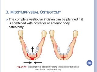 3. MIDSYMPHYSEAL OSTEOTOMY
 The complete vestibular incision can be planned if it
is combined with posterior or anterior body
osteotomy.
109
 