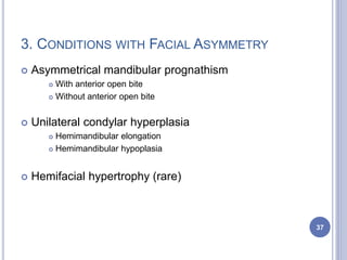 3. CONDITIONS WITH FACIAL ASYMMETRY
 Asymmetrical mandibular prognathism
 With anterior open bite
 Without anterior open bite
 Unilateral condylar hyperplasia
 Hemimandibular elongation
 Hemimandibular hypoplasia
 Hemifacial hypertrophy (rare)
37
 