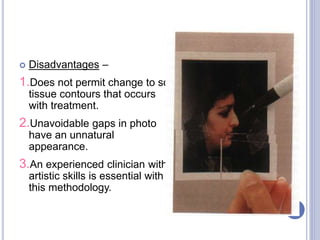  Disadvantages –
1.Does not permit change to soft
tissue contours that occurs
with treatment.
2.Unavoidable gaps in photo
have an unnatural
appearance.
3.An experienced clinician with
artistic skills is essential with
this methodology.
84
 