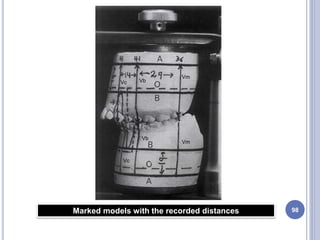 98Marked models with the recorded distances
Vm
VbVc
Vm
Vb
Vc
 