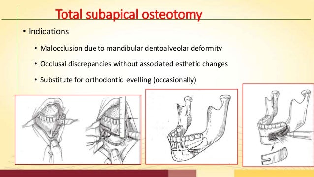 Plaquenil screening guidelines ophthalmology