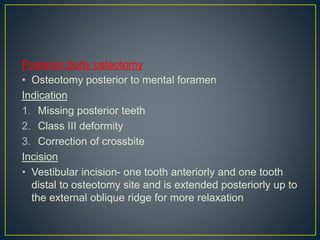 Posterior body osteotomy
• Osteotomy posterior to mental foramen
Indication
1. Missing posterior teeth
2. Class III deformity
3. Correction of crossbite
Incision
• Vestibular incision- one tooth anteriorly and one tooth
distal to osteotomy site and is extended posteriorly up to
the external oblique ridge for more relaxation
 