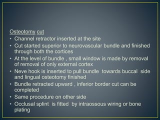 Osteotomy cut
• Channel retractor inserted at the site
• Cut started superior to neurovascular bundle and finished
through both the cortices
• At the level of bundle , small window is made by removal
of removal of only external cortex
• Neve hook is inserted to pull bundle towards buccal side
and lingual osteotomy finished
• Bundle retracted upward , inferior border cut can be
completed
• Same procedure on other side
• Occlusal splint is fitted by intraossous wiring or bone
plating
 