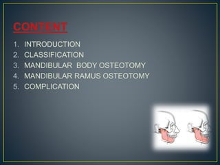 1. INTRODUCTION
2. CLASSIFICATION
3. MANDIBULAR BODY OSTEOTOMY
4. MANDIBULAR RAMUS OSTEOTOMY
5. COMPLICATION
 