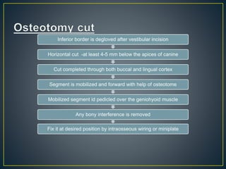 Inferior border is degloved after vestibular incision
Horizontal cut -at least 4-5 mm below the apices of canine
Cut completed through both buccal and lingual cortex
Segment is mobilized and forward with help of osteotome
Mobilized segment id pedicled over the geniohyoid muscle
Any bony interference is removed
Fix it at desired position by intraosseous wiring or miniplate
 