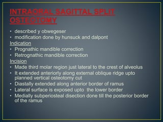 • described y obwegeser
• modification done by hunsuck and dalpont
Indication
• Prognathic mandible correction
• Retrognathic mandible correction
Incision
• Made third molar region just lateral to the crest of alveolus
• It extended anteriorly along external oblique ridge upto
planned vertical osteotomy cut
• Diastally extended along anterior border of ramus
• Lateral surface is exposed upto the lower border
• Medially subperiosteal disection done till the posterior border
of the ramus
 