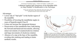 Mandibular osteotomies.pptx