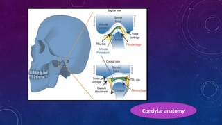 Condylar anatomy
 