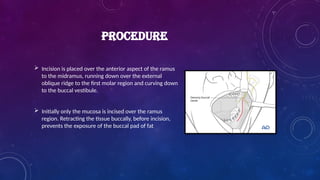  Incision is placed over the anterior aspect of the ramus
to the midramus, running down over the external
oblique ridge to the first molar region and curving down
to the buccal vestibule.
 Initially only the mucosa is incised over the ramus
region. Retracting the tissue buccally, before incision,
prevents the exposure of the buccal pad of fat
PROCEDURE
 