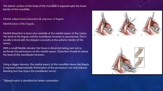 The lateral surface of the body of the mandible is exposed upto the lower
border of the mandible.
Medial subperiosteal dissection & exposure of lingula
Identification of the lingula.
Medial dissection is done very carefully at the medial aspect of the ramus.
The level of the lingula and the mandibular foramen is ascertained. This is
usually in level with the deepest concavity at the anterior border of the
ramus.
With a small flexible elevator the tissue is dissected taking care not to
perforate the periosteum on the medial aspect. Dissection should be above
the level of the mandibular foramen.
Using a bigger elevator, the medial aspect of the mandible above the lingula
is exposed subperiosteally (Perforation of the periosteum not only induces
bleeding but may injure the mandibular nerve).
Sigmoid notch is identified for better orientation.
 