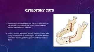 OSTEOTOMY CUTS
• Osteotomy is initiated by cutting the cortical bone above
the lingula on the medial side. This cut should extend
behind the mandibular foramen.
• The cut is taken downward and the external oblique ridge
along to the 2nd or 1st molar region. The depth of the cut
should be minimal, just enough to reach the cancellous
bone
 
