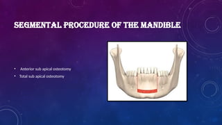 SEGMENTAL PROCEDURE OF THE MANDIBLE
• Anterior sub apical osteotomy
• Total sub apical osteotomy
 