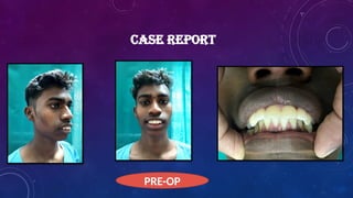 CASE REPORT
PRE-OP
 