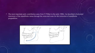 • The most important early contribution came from V P Blair in the early 1900s - he described a horizontal
osteotomy of the mandibular ramus through the extra-oral route for the correction of mandibular
prognathism.
 