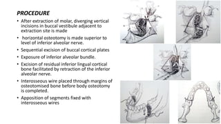 Mandibular osteotomy and genioplasty | PPTX