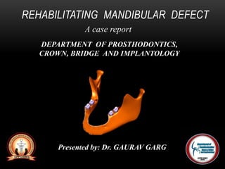 REHABILITATING MANDIBULAR DEFECT
A case report
Presented by: Dr. GAURAV GARG
DEPARTMENT OF PROSTHODONTICS,
CROWN, BRIDGE AND IMPLANTOLOGY
 