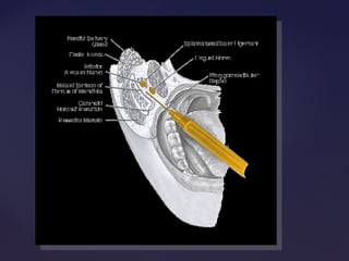 Mandibular block techniques | PPT