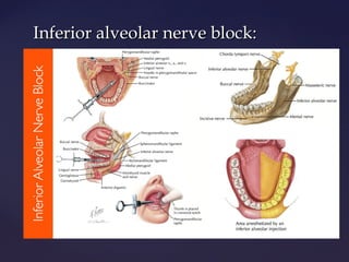 Mandibular block techniques | PPT