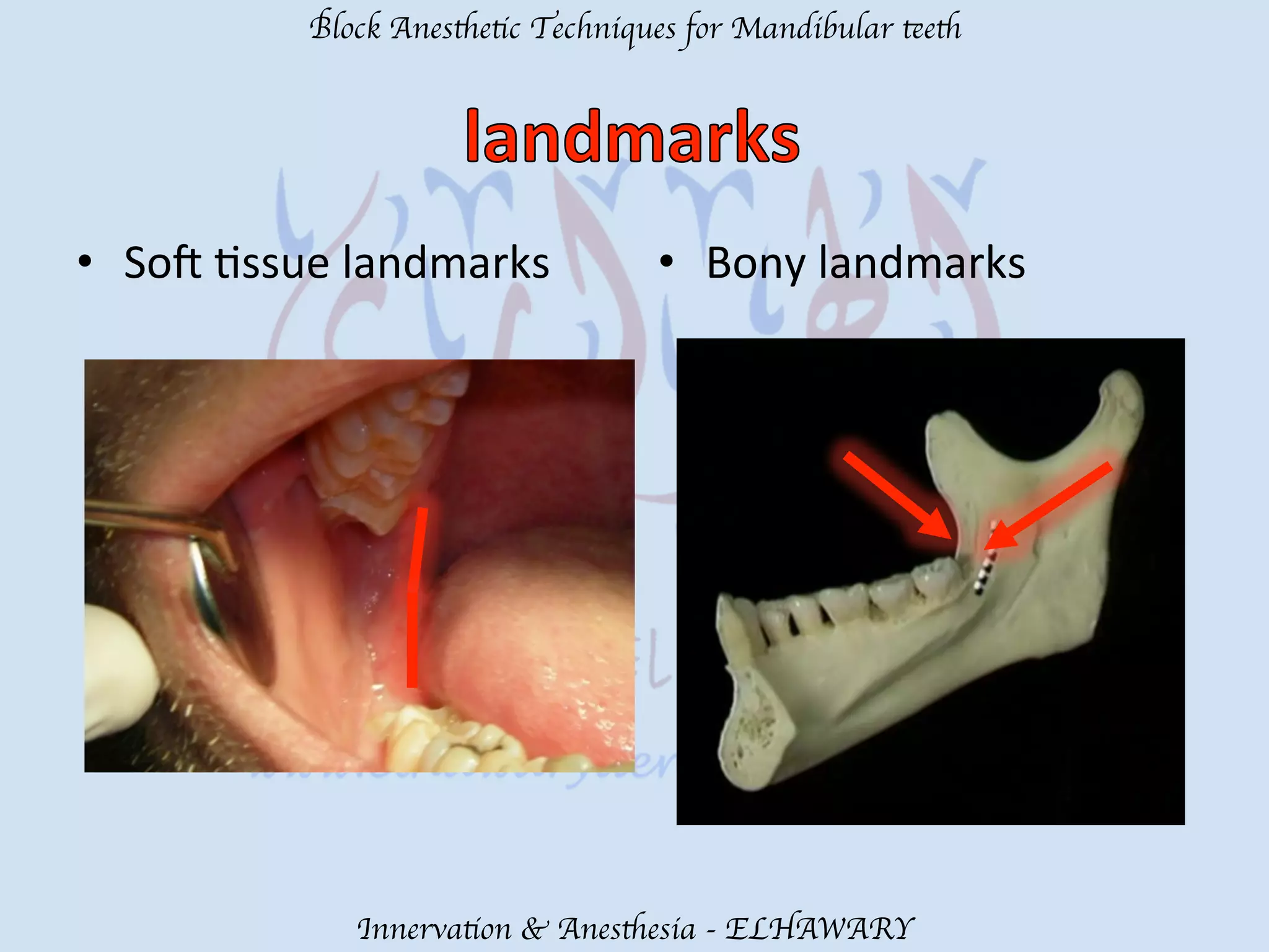 Mandibular teeth anesthetic block techniques | PDF
