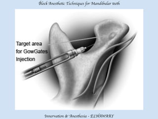 Mandibular teeth anesthetic block techniques | PDF