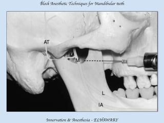 Mandibular teeth anesthetic block techniques | PDF