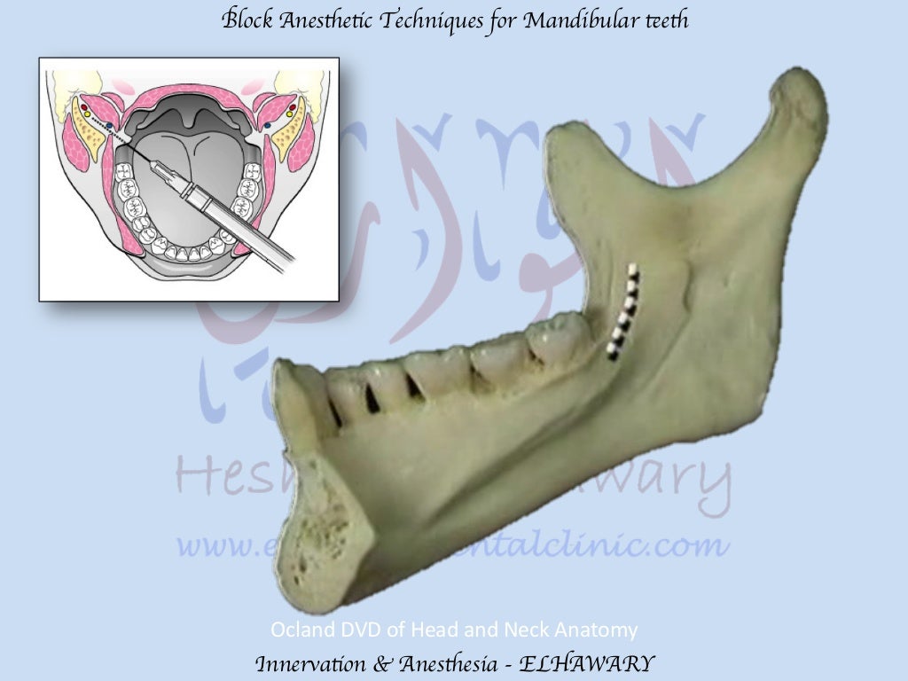 Mandibular teeth anesthetic block techniques