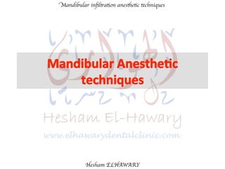 Mandibular inﬁltration anesthetic techniques
Hesham ELHAWARY
 