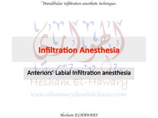 Mandibular inﬁltration anesthetic techniques
Hesham ELHAWARY
 