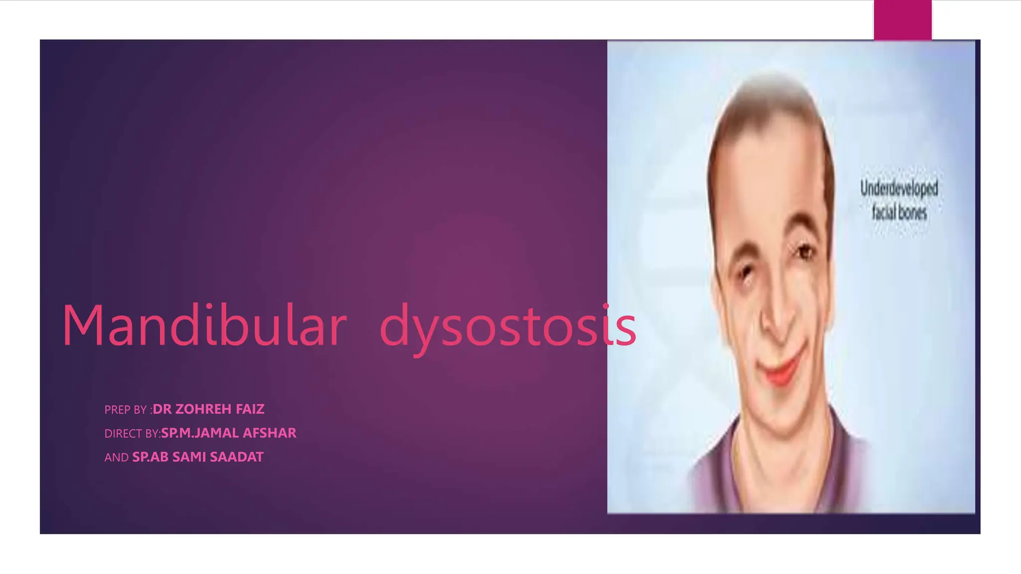 Mandibulofacial dysostosis.pptx
