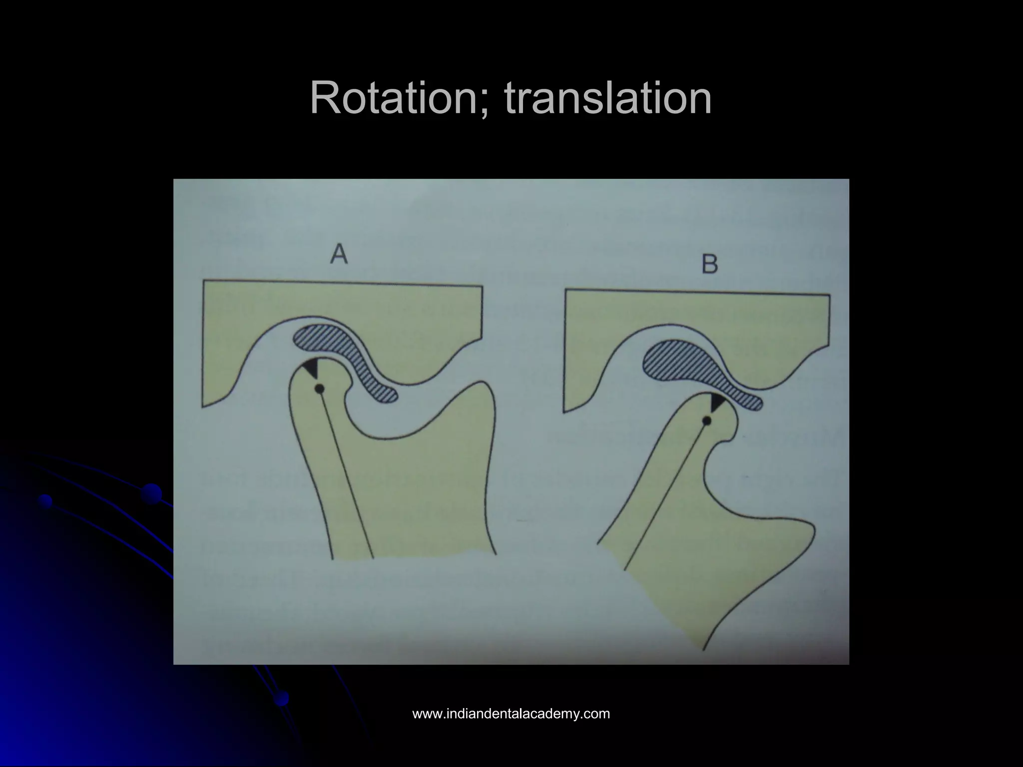 Rotation; translationRotation; translation
www.indiandentalacademy.comwww.indiandentalacademy.com
 