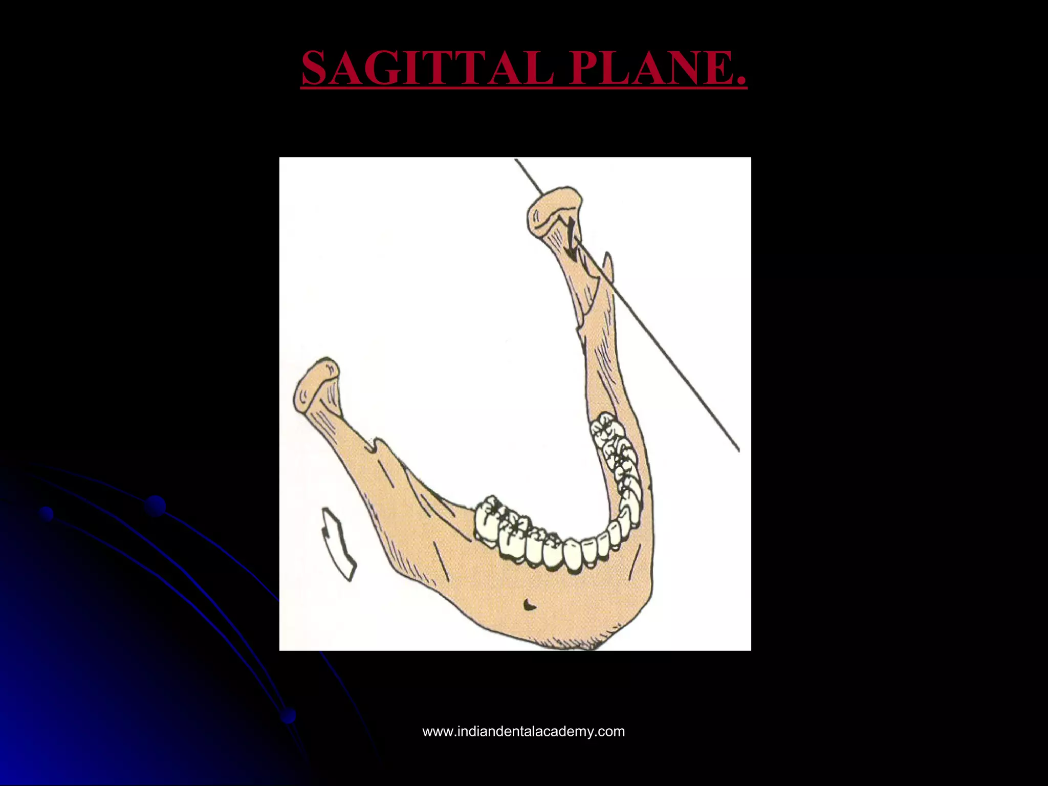 SAGITTAL PLANE.SAGITTAL PLANE.
www.indiandentalacademy.comwww.indiandentalacademy.com
 