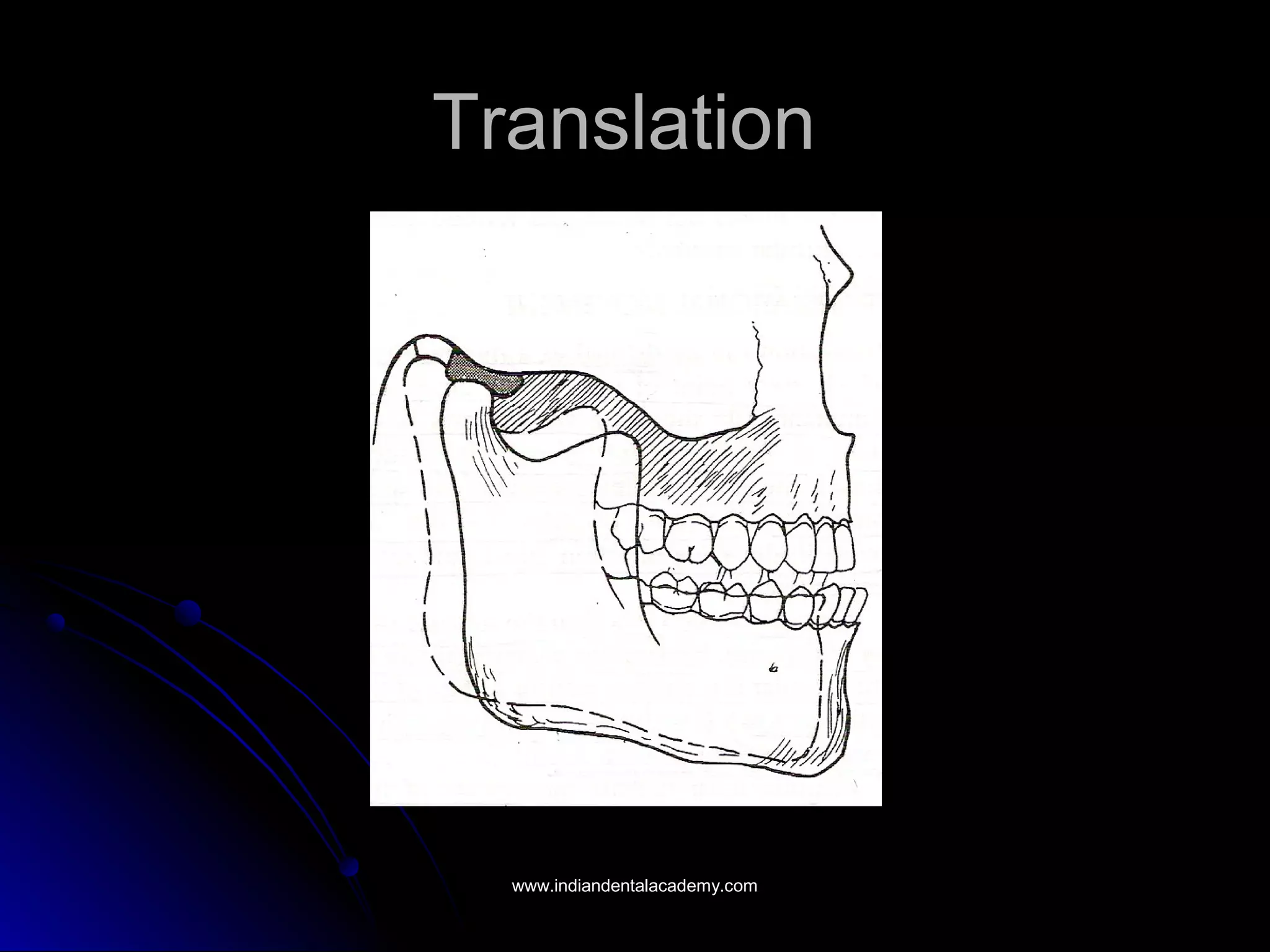 TranslationTranslation
www.indiandentalacademy.comwww.indiandentalacademy.com
 