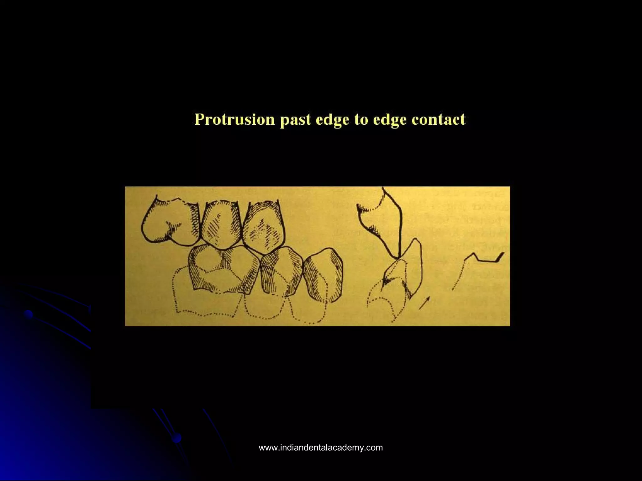 www.indiandentalacademy.comwww.indiandentalacademy.com
 