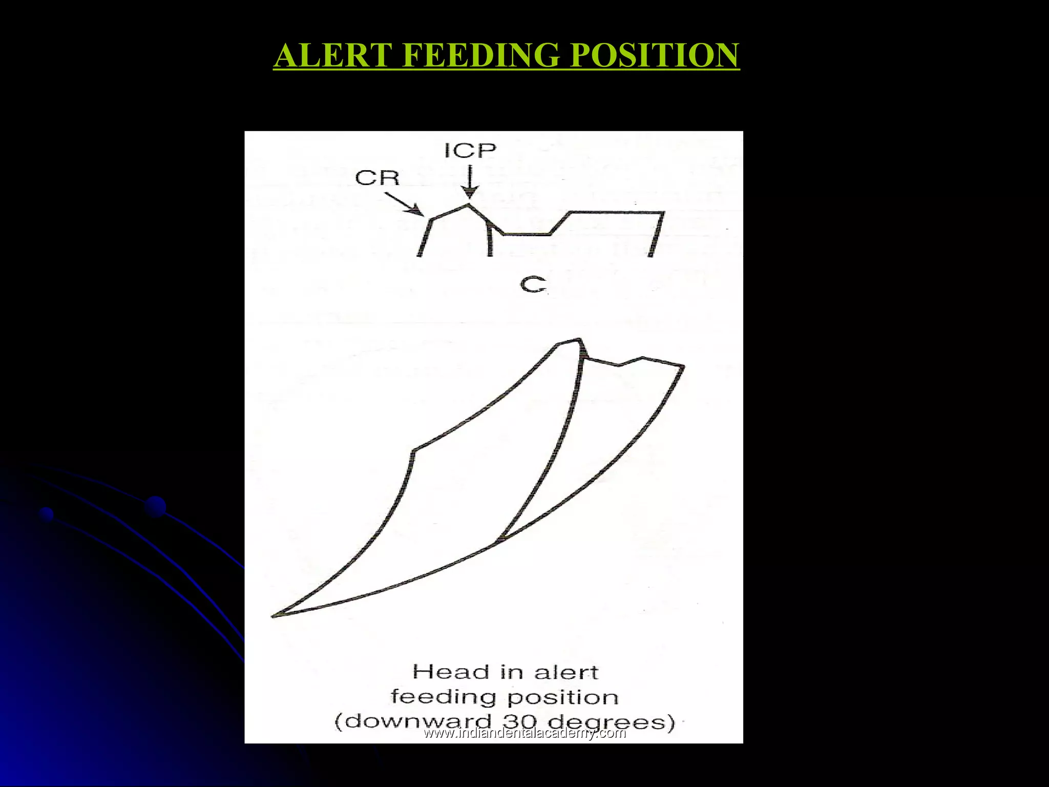 ALERT FEEDING POSITIONALERT FEEDING POSITION
www.indiandentalacademy.comwww.indiandentalacademy.com
 