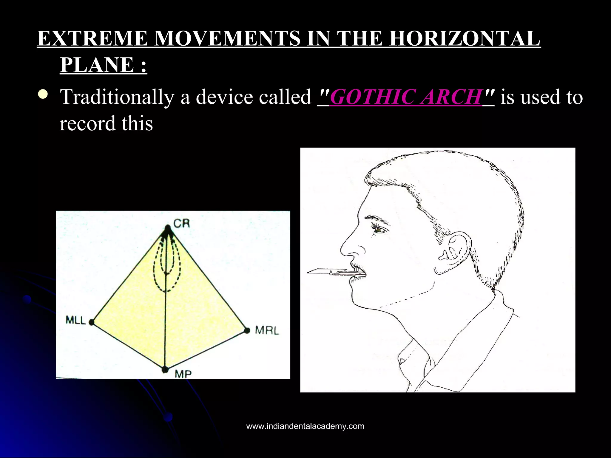 EXTREME MOVEMENTS IN THE HORIZONTALEXTREME MOVEMENTS IN THE HORIZONTAL
PLANE :PLANE :
 Traditionally a device calledTraditionally a device called ""GOTHIC ARCHGOTHIC ARCH"" is used tois used to
record thisrecord this
www.indiandentalacademy.comwww.indiandentalacademy.com
 