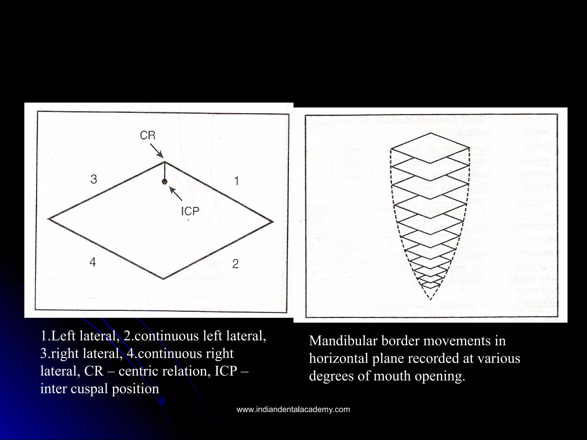 Mandibular border movements in
horizontal plane recorded at various
degrees of mouth opening.
1.Left lateral, 2.continuous left lateral,
3.right lateral, 4.continuous right
lateral, CR – centric relation, ICP –
inter cuspal position
www.indiandentalacademy.comwww.indiandentalacademy.com
 