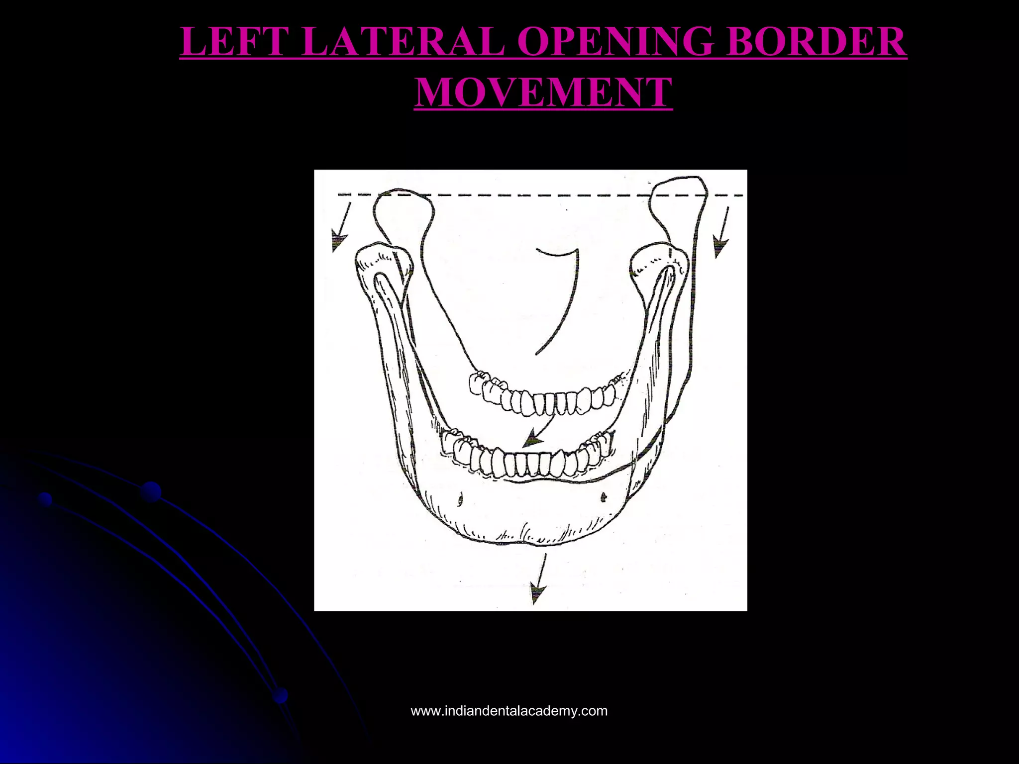 LEFT LATERAL OPENING BORDERLEFT LATERAL OPENING BORDER
MOVEMENTMOVEMENT
www.indiandentalacademy.comwww.indiandentalacademy.com
 