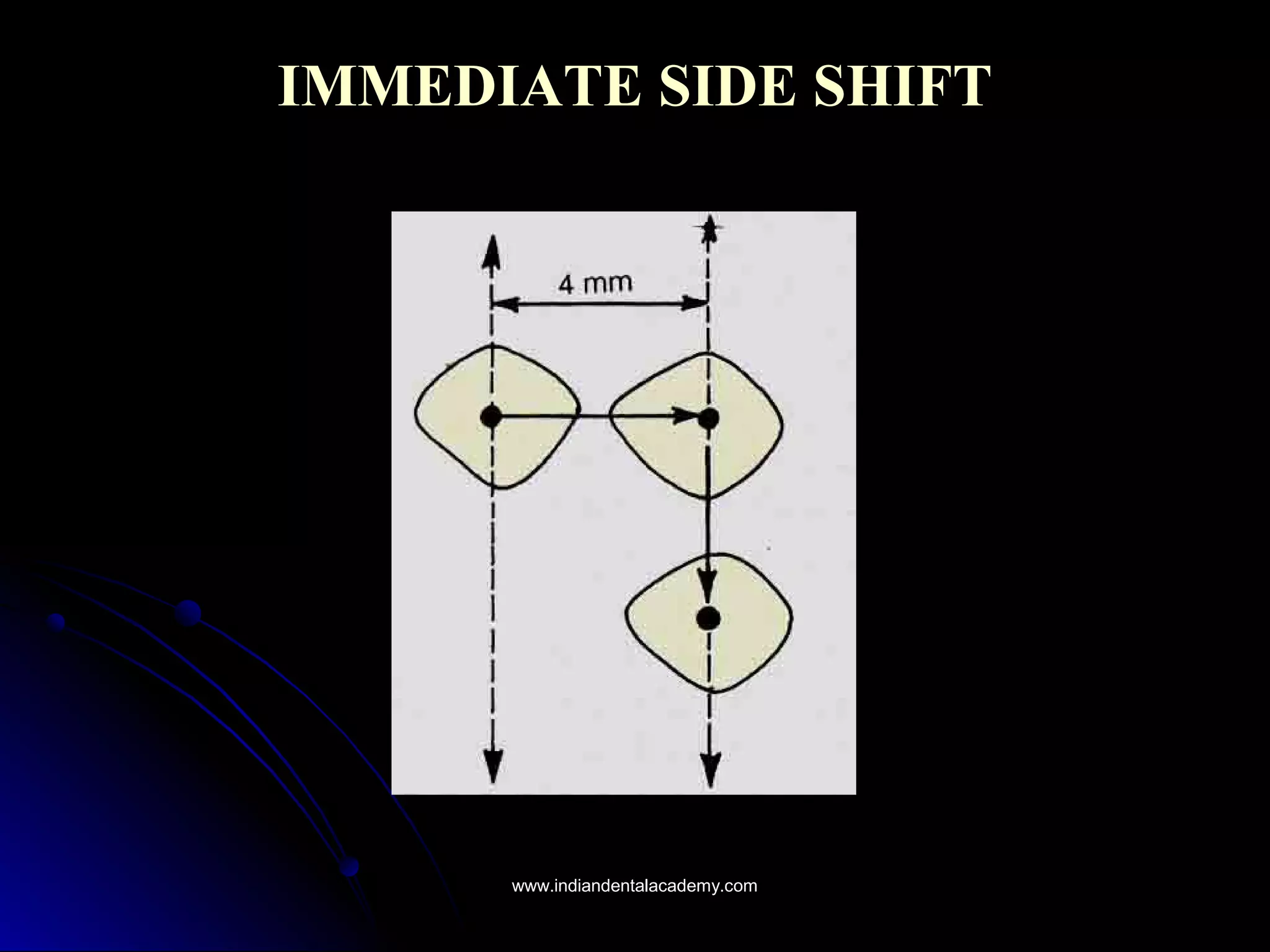 IMMEDIATE SIDE SHIFTIMMEDIATE SIDE SHIFT
www.indiandentalacademy.comwww.indiandentalacademy.com
 