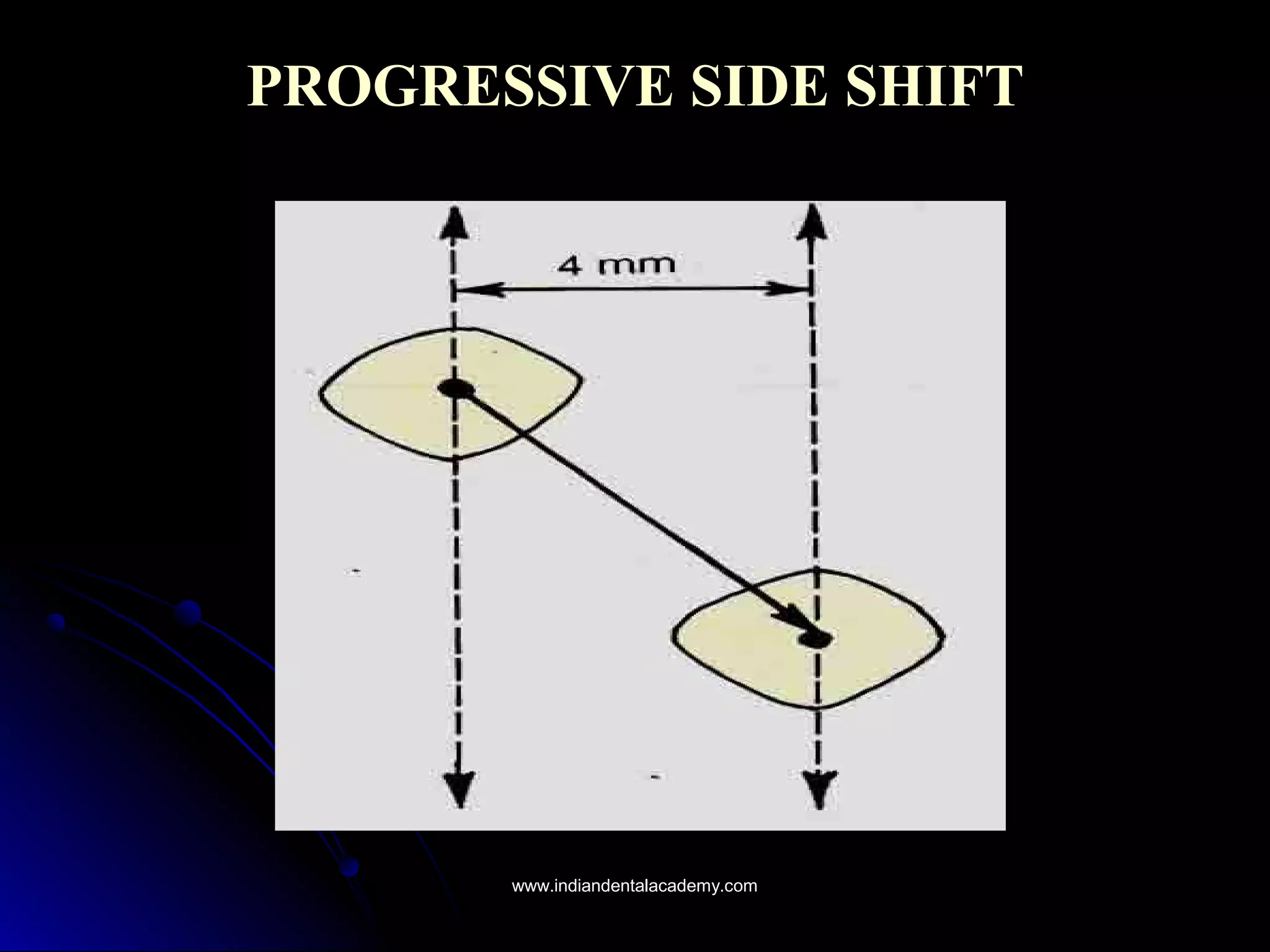 PROGRESSIVE SIDE SHIFTPROGRESSIVE SIDE SHIFT
www.indiandentalacademy.comwww.indiandentalacademy.com
 