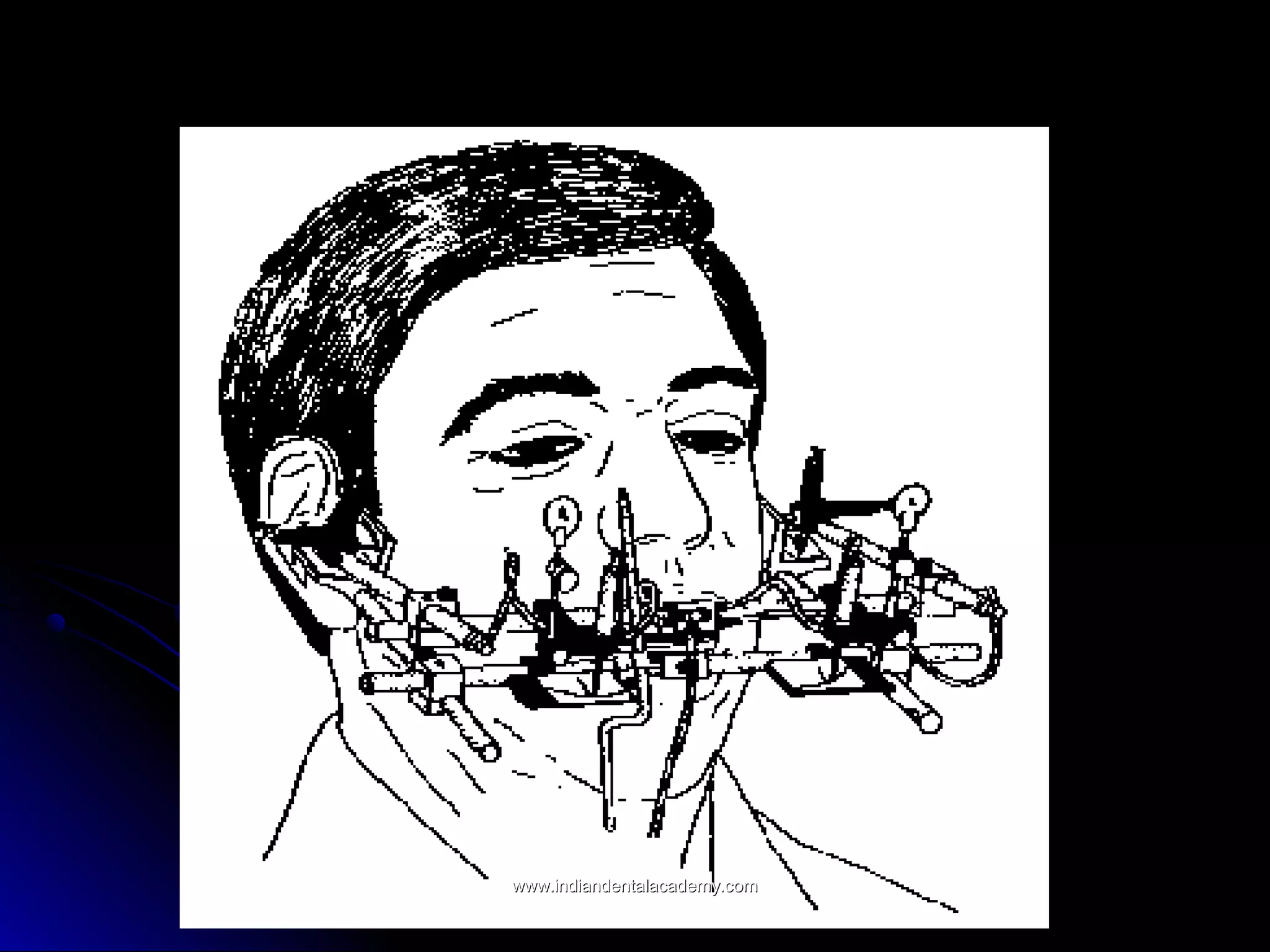 www.indiandentalacademy.comwww.indiandentalacademy.com
 