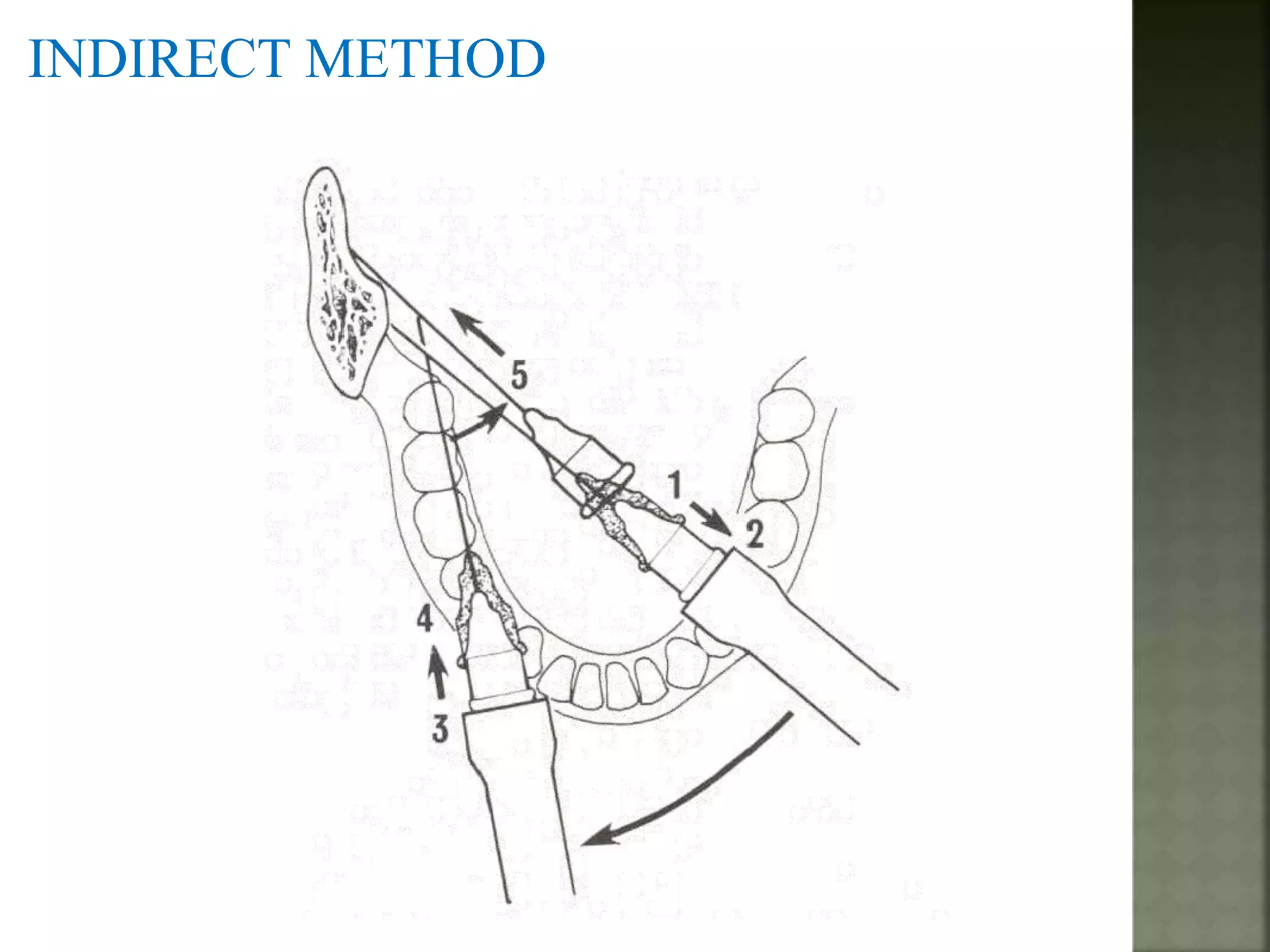 Mandibular nerve blocks techniques | PPTX