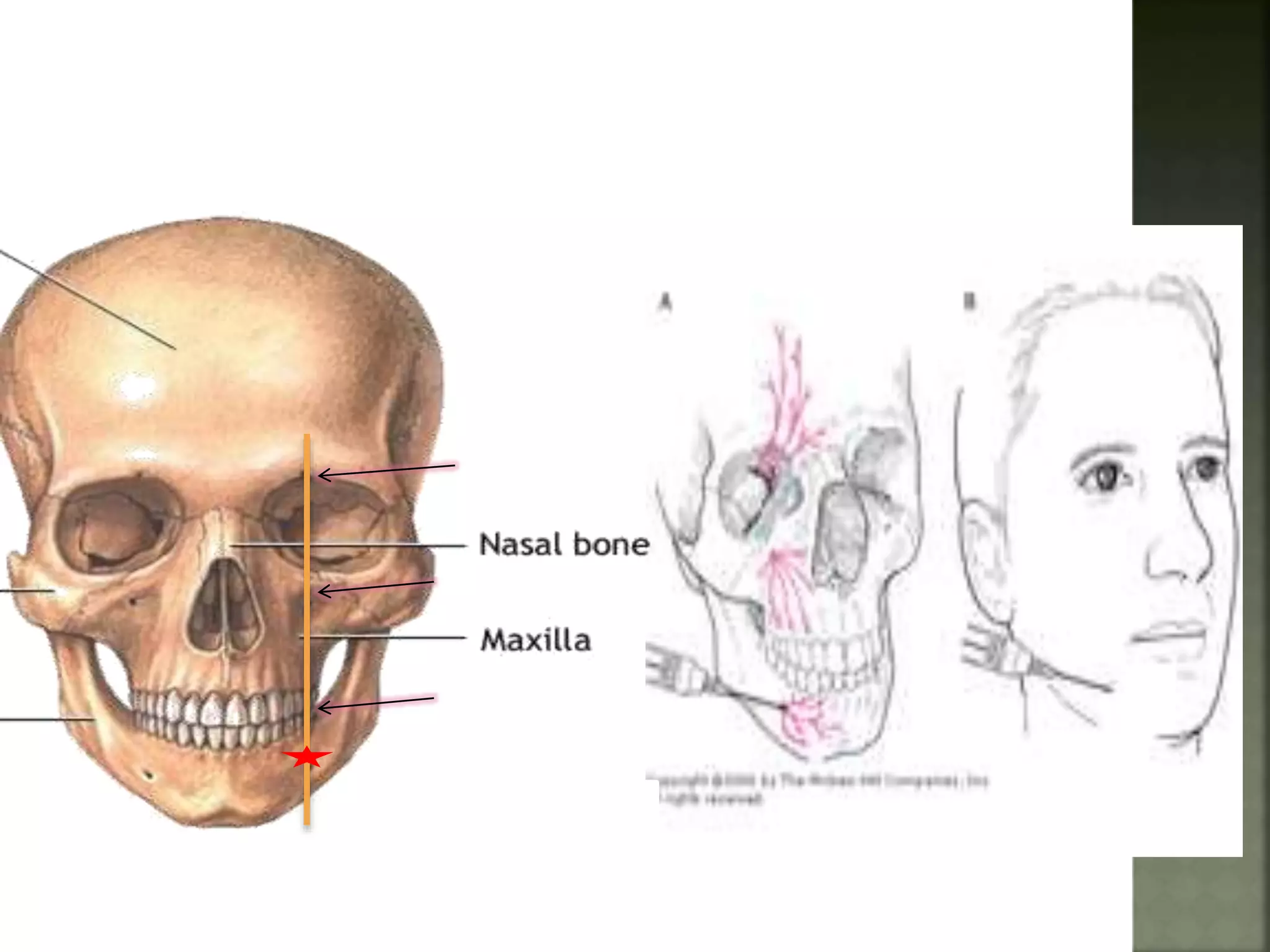 Mandibular nerve blocks techniques | PPTX