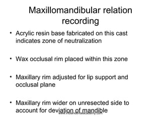 Maxillomandibular relation
recording
• Acrylic resin base fabricated on this cast
indicates zone of neutralization
• Wax o...