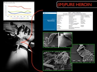 (IM)PURE HEROIN
 