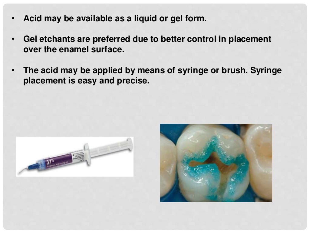 bonding to enamel & dentin