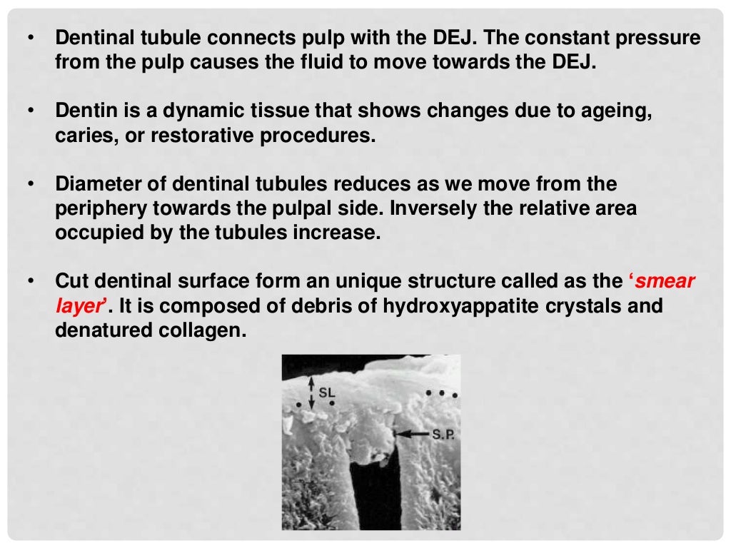 bonding to enamel & dentin