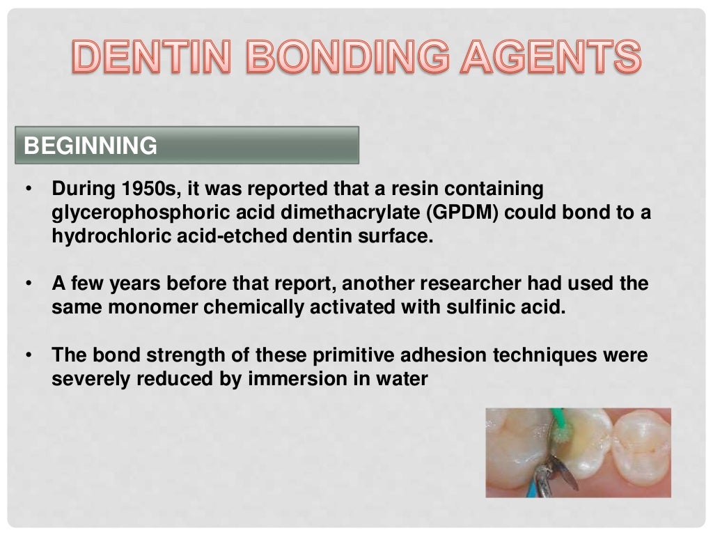 bonding to enamel & dentin