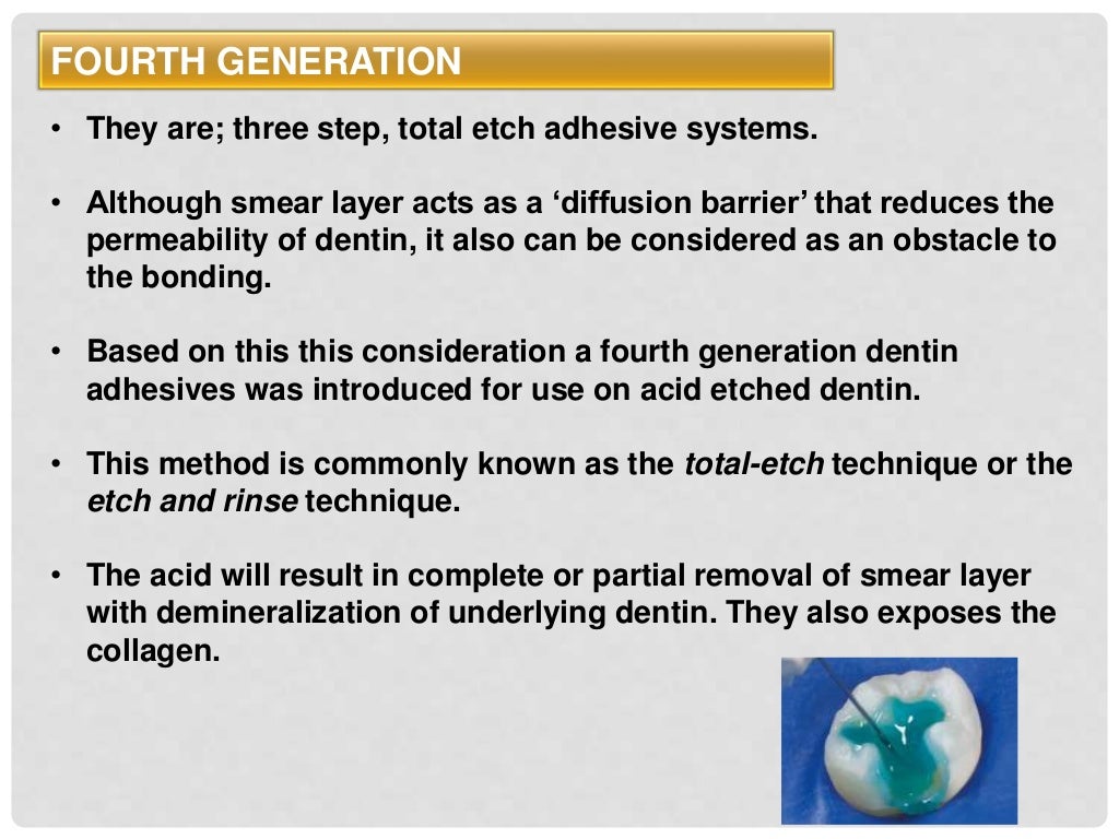 bonding to enamel & dentin