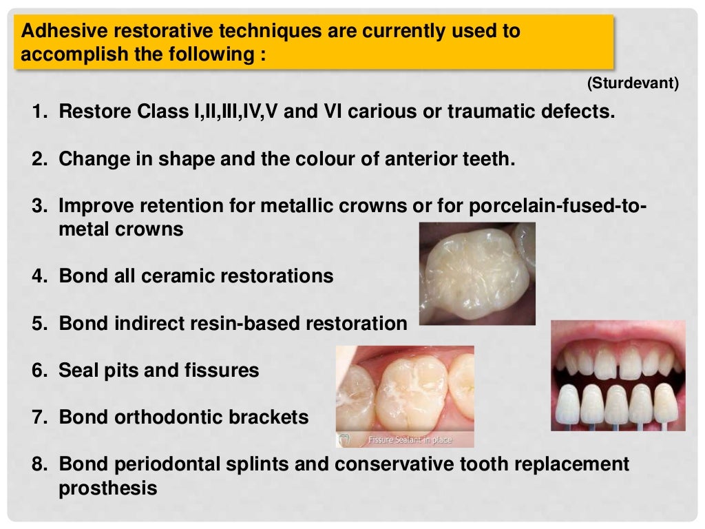 bonding to enamel & dentin